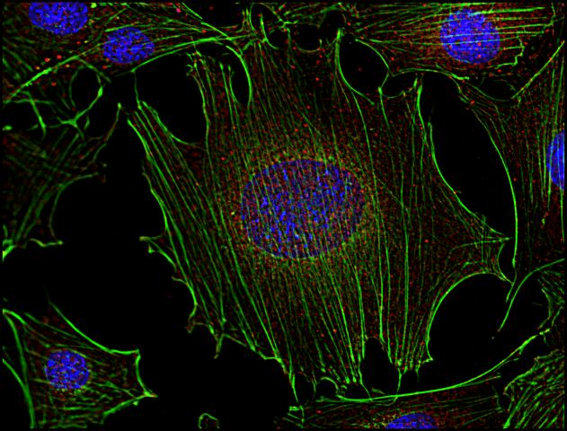 IHC-plus™ Monoclonal Mouse anti-Human SYN / FYN Antibody (clone FYN-01, aa7-176, IHC, WB)