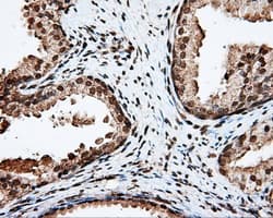 APP / Beta Amyloid Precursor Antibody (clone OTI2B10)