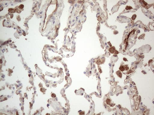 Monoclonal Mouse anti-Human PROCR / EPCR Antibody (clone OTI12H5, aa1-210, IHC, WB)