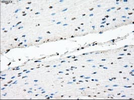 Monoclonal Mouse anti-Human TMEM100 Antibody (clone OTI10G3, IHC, IF, WB)