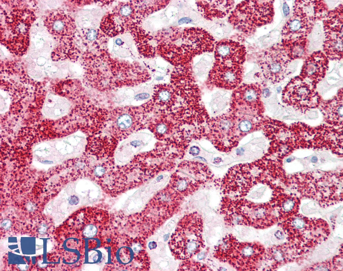 IHC-plus™ TGM5 / Transglutaminase 5 Antibody