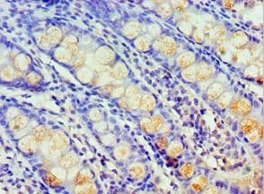 HARS Antibody (aa1-180)