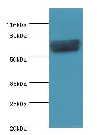GRK4 Antibody (aa1-245)