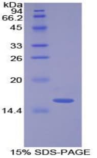 Bovine LYZ / Lysozyme Protein (Recombinant His)
