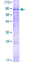Human ZDHHC1 Protein (Recombinant GST)