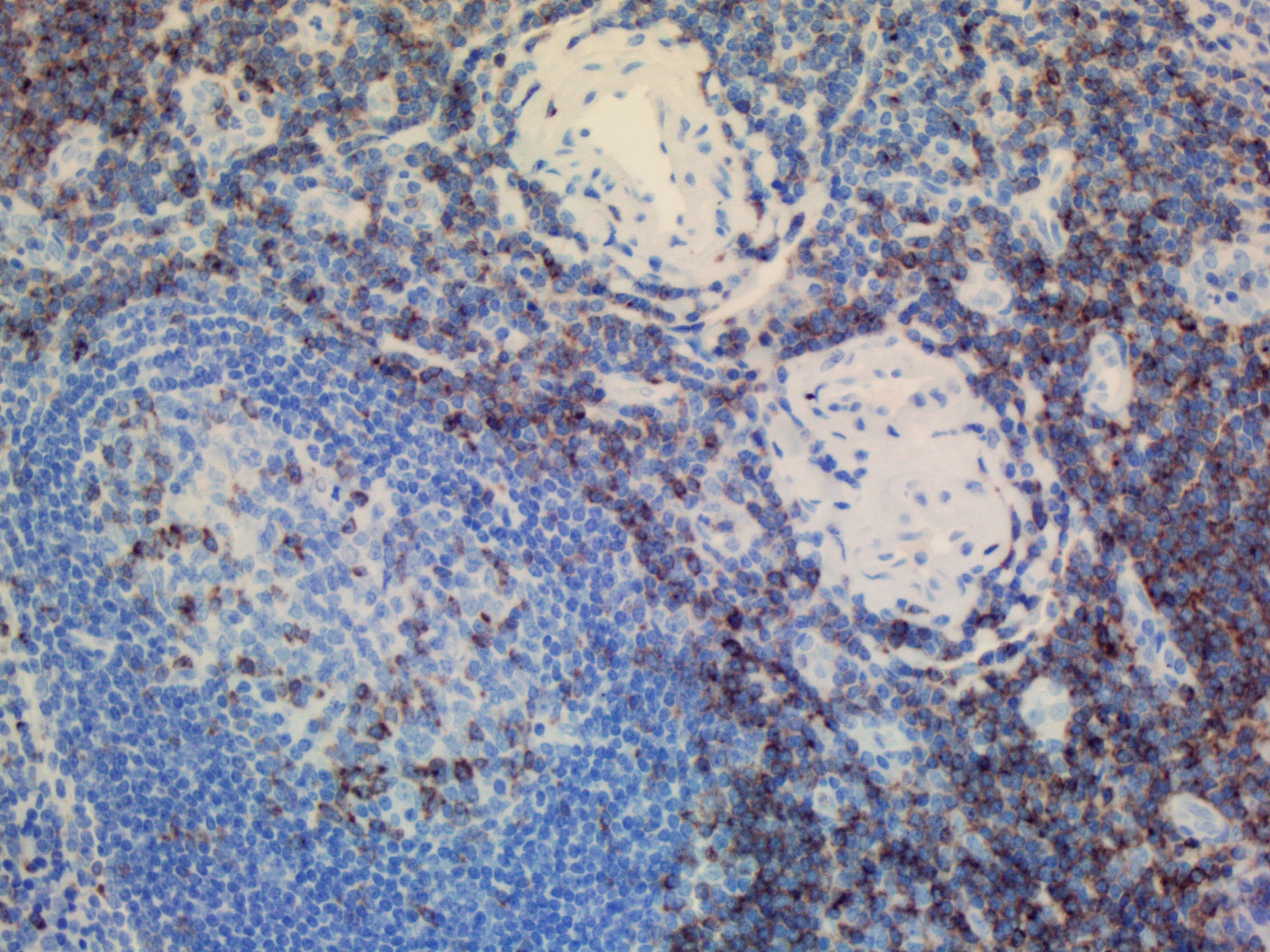 Monoclonal Mouse anti-Human CD2 Antibody (clone UMAB6, Carrier-free, IHC, IF, WB)