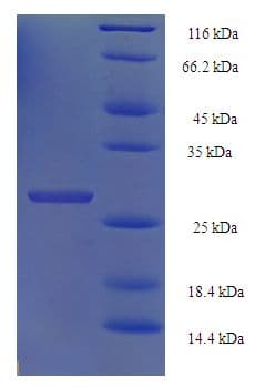 Human HIST1H2BN Protein (Recombinant His-SUMO)