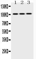 Polyclonal Rabbit anti-Human HK2 / Hexokinase 2 Antibody (WB)