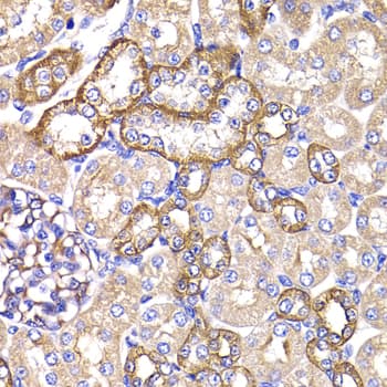 PPL / Periplakin Antibody