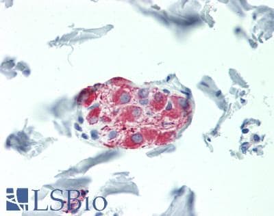 Polyclonal Rabbit anti-Human RPL11 / Ribosomal Protein L11 Antibody (IHC, IF)