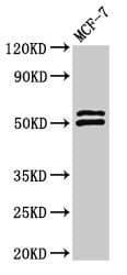 Polyclonal Rabbit anti-Human NCF2 / NOXA2 / p67phox Antibody (IHC, IF, WB)