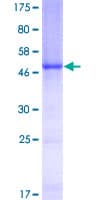 Human Complement C1QB Protein (Recombinant GST)