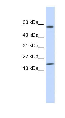 KRTAP11-1 Antibody (N-Terminus)