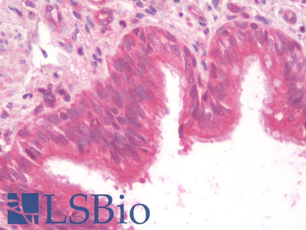 NOD2 / CARD15 Antibody (aa125-140)