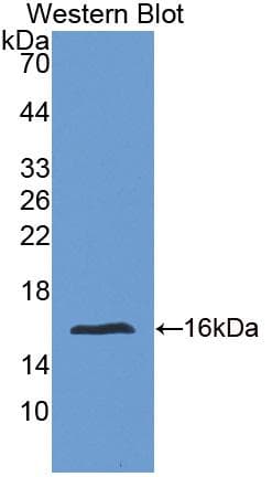 Polyclonal Rabbit anti-Human FBN1 / Fibrillin 1 Antibody (WB)