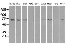 Heat Shock Protein 70 / HSPA1A Antibody (clone OTI1B2)