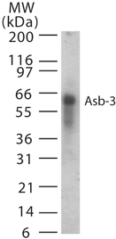 Polyclonal Rabbit anti-Human ASB3 Antibody (aa63-75, WB)