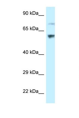 RSL1D1 Antibody (aa401-450)
