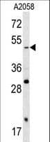 SOX4 Antibody (aa86-114)