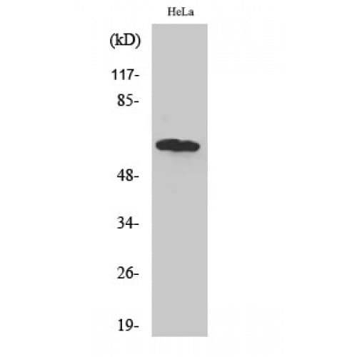Polyclonal Rabbit anti-Human TBC1D3A + TBC1D3B + TBC1D3C Antibody (450-530 aa, C-terminal, WB)