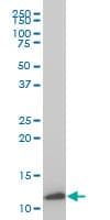 TIMM9 Antibody (clone 1D6)