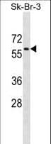 Polyclonal Rabbit anti-Human PRKAA1 / AMPK Alpha 1 Antibody (aa479-510, WB)