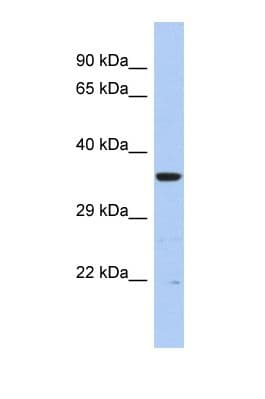 Polyclonal Rabbit anti-Human MCCC2 / MCCB Antibody (aa250-299, WB)