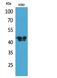 BCAT1 / ECA39 Antibody