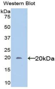 IL6ST / CD130 / gp130 Antibody (aa392-566)