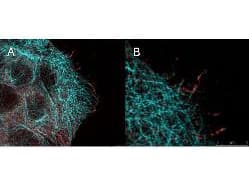 AKT1 Antibody (phospho-Ser473, clone 17F6.B11)