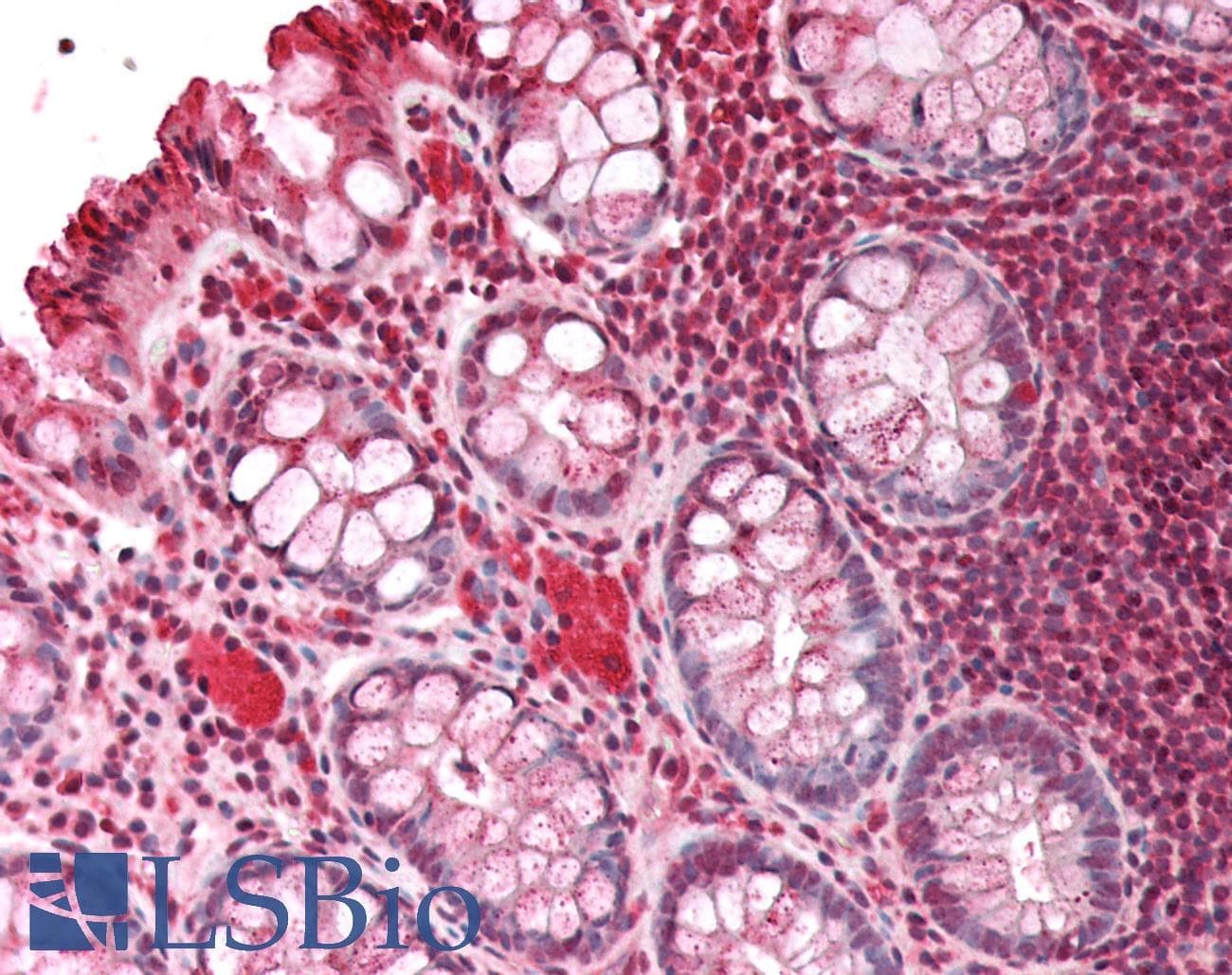 IHC-plus™ Polyclonal Rabbit anti-Human HBXIP Antibody (IHC, WB)