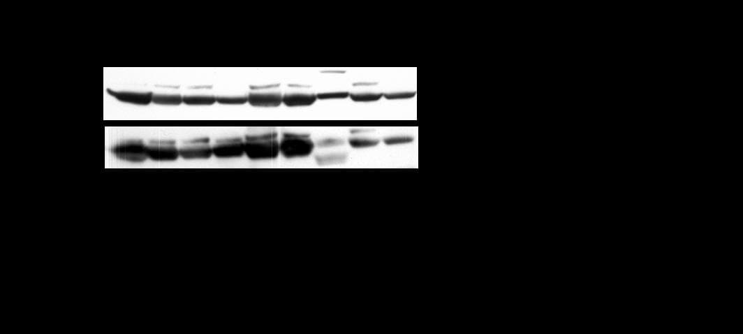 RELA / NFKB p65 Antibody (phospho-Ser276)
