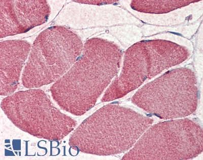 IHC-plus™ NEDD4 Antibody (aa725-775)