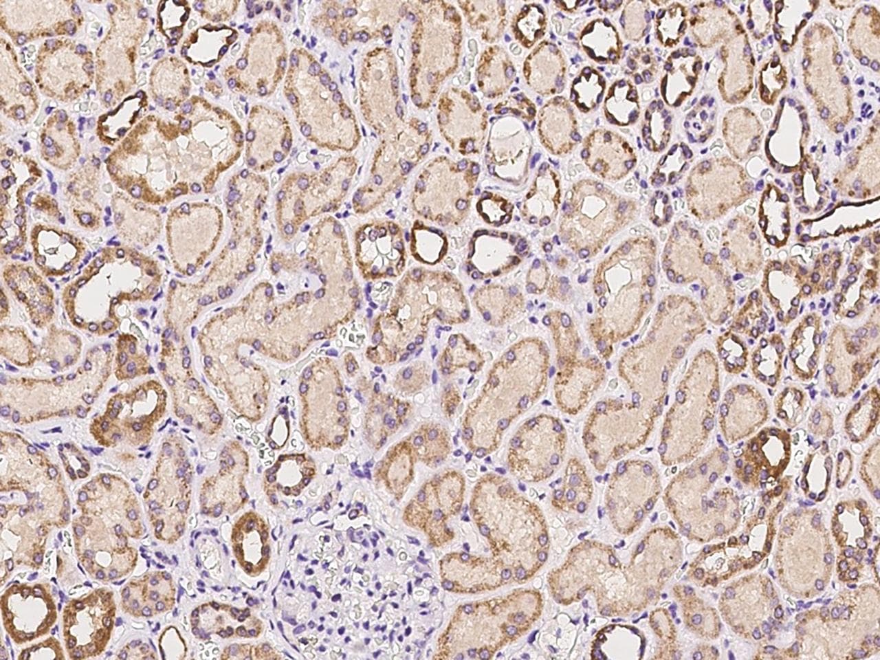 MCCC2 / MCCB Antibody
