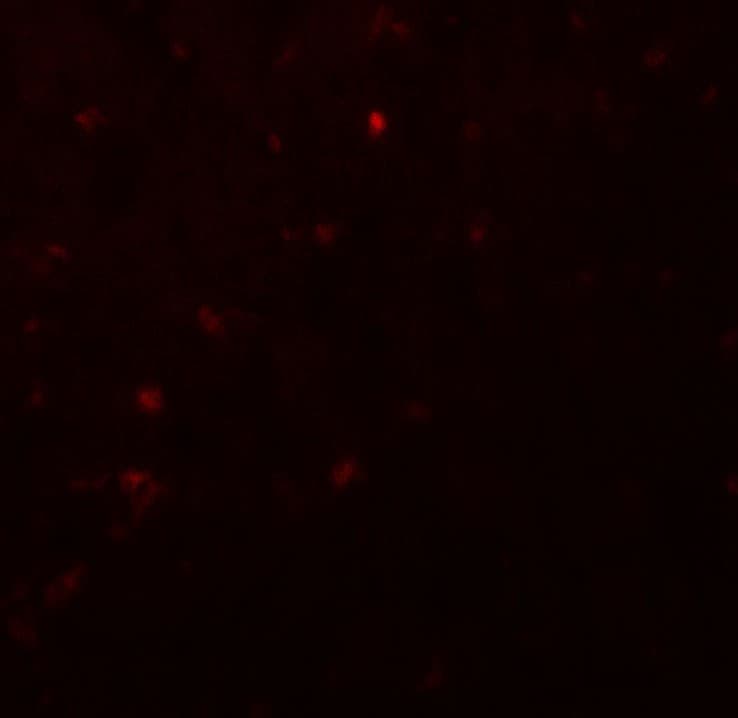 IKZF2 / HELIOS Antibody