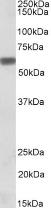 IHC-plus™ Polyclonal Goat anti-Human SPP1 / Osteopontin Antibody (aa288-299, IHC, WB)
