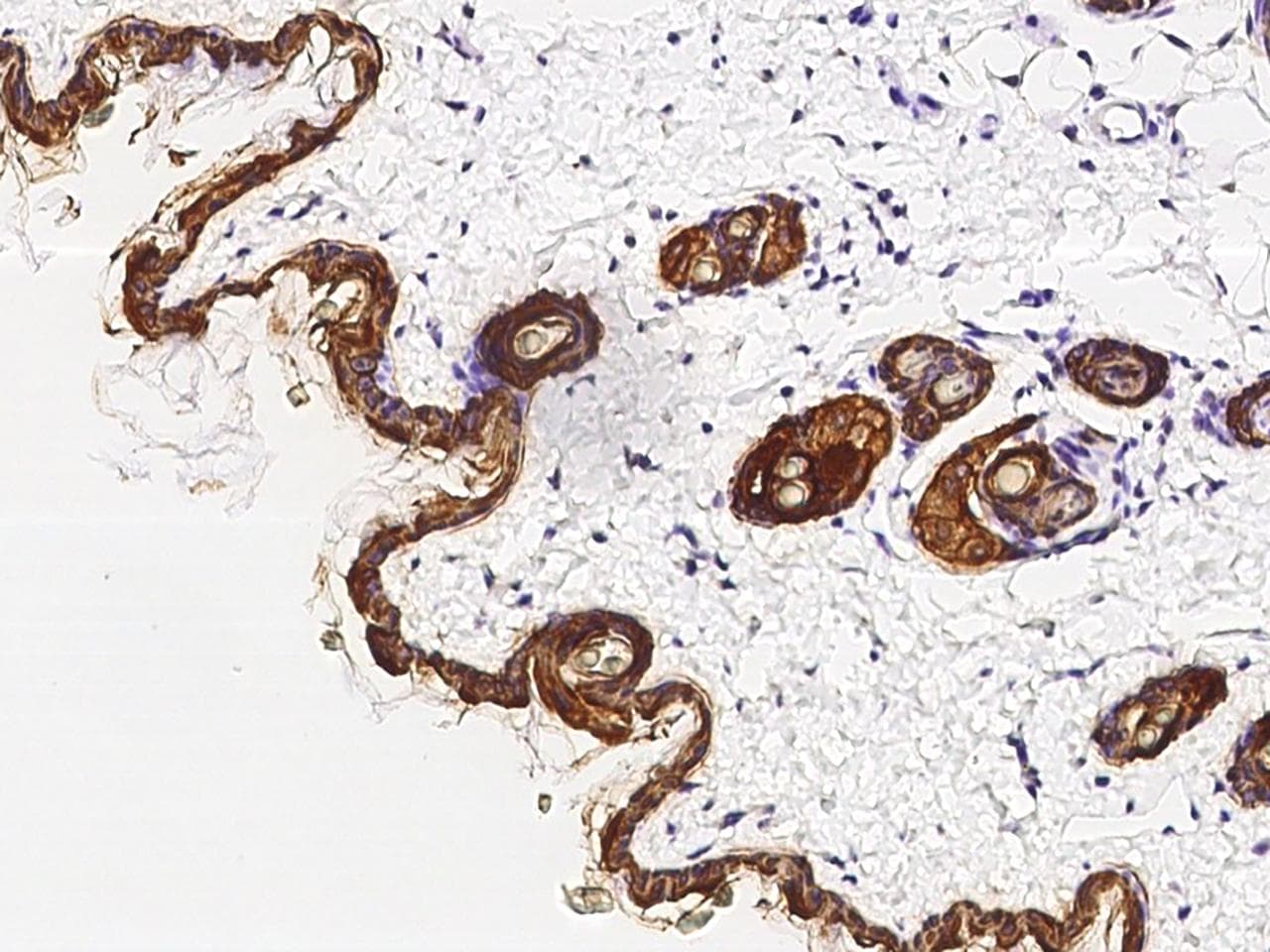 Polyclonal Rabbit anti-Human KRT79 / Keratin 79 Antibody (IHC)