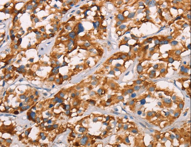 SPR Antibody