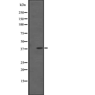 Polyclonal Rabbit anti-Human FPR2 / FPRL1 Antibody (IHC, WB)