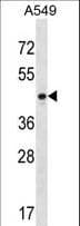 PTX3 / Pentraxin 3 Antibody (aa120-148)