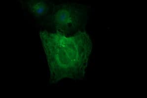 TUBB2A / Tubulin Beta 2A Antibody (clone OTI3E6)