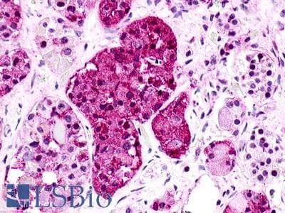 PathPlus™ Polyclonal Rabbit anti-Human GPR176 Antibody (C-Terminus, IHC)