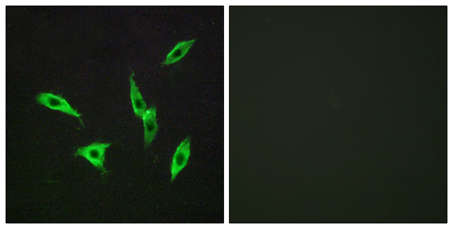 ADORA2B/Adenosine A2B Receptor Antibody (aa231-280)