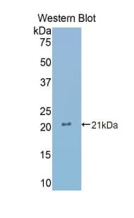 GNRH Antibody (aa22-140, PE)