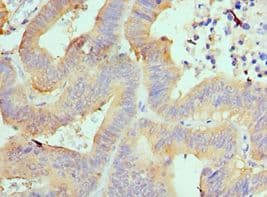 AIMP1 / EMAP II Antibody (aa25-180)
