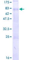 Human FZD5 / Frizzled 5 Protein (Recombinant GST)