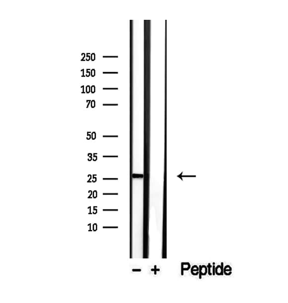 SAT1 / SAT Antibody