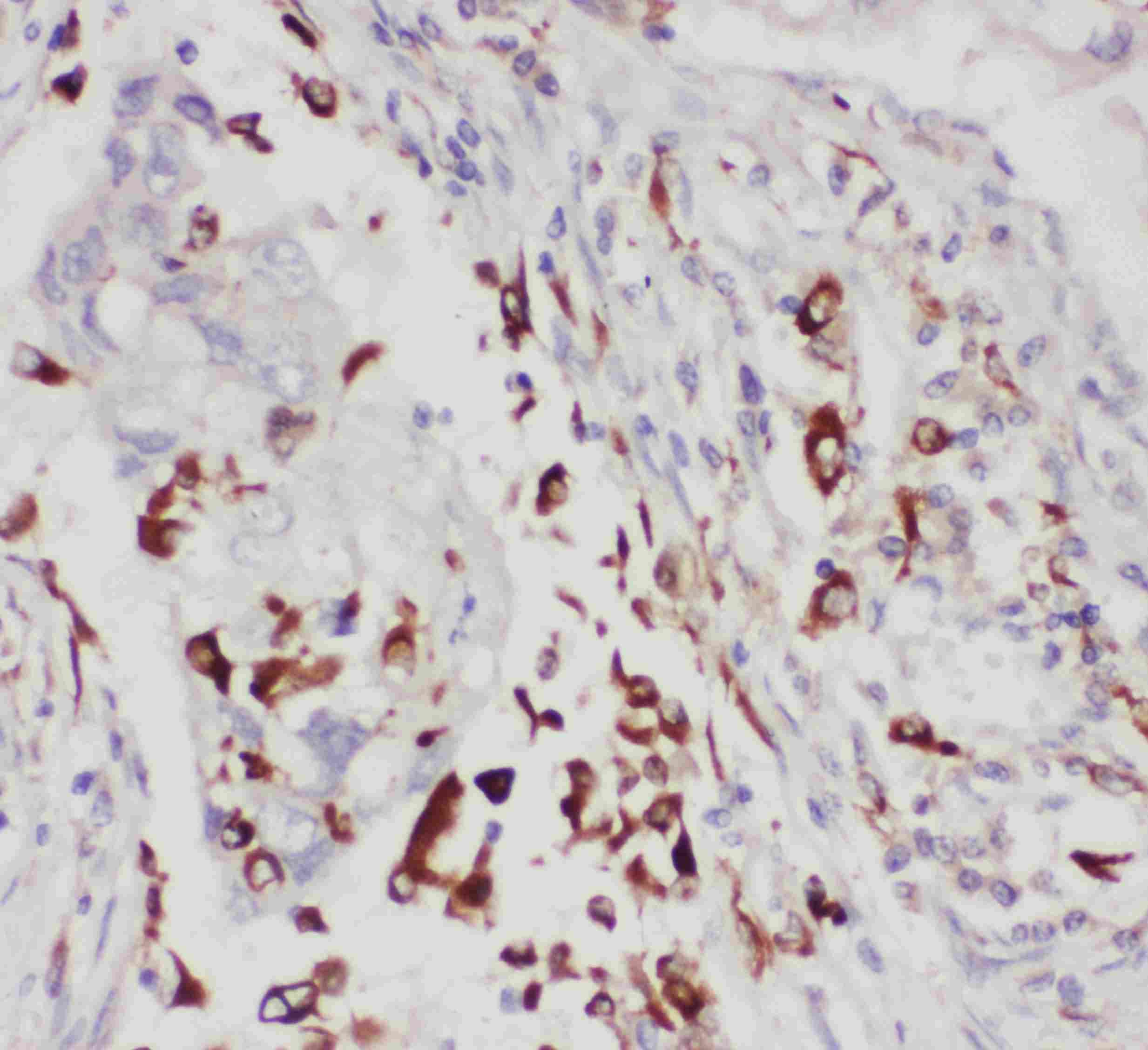 ALOX5 / 5-LOX Antibody (aa650-667)