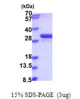 Human NUBP2 Protein (Recombinant His)