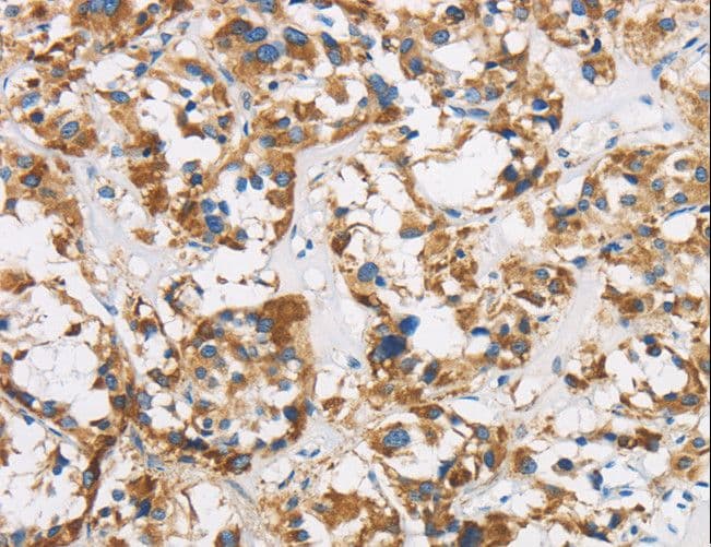 Polyclonal Rabbit anti-Human COXG / COX6B1 Antibody (IHC, WB)